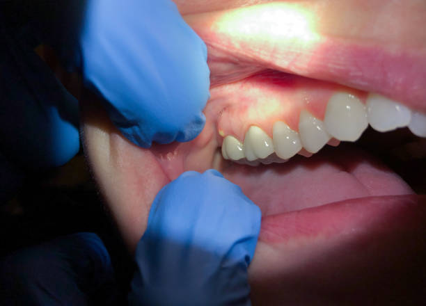 Best Orthodontic Emergency Dentist in Arthurtown, SC