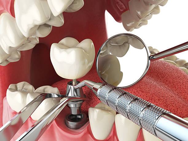 Best Pediatric Emergency Dentist in Arthurtown, SC